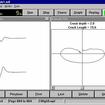 Пример вывода данных ACFM 